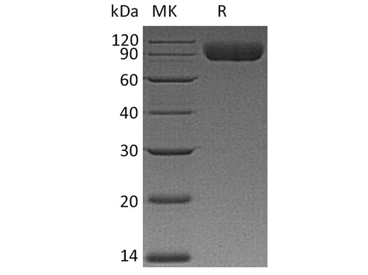 Recombinant Human CD172a/SIRPA Protein (mFc Tag) - ABMIUM