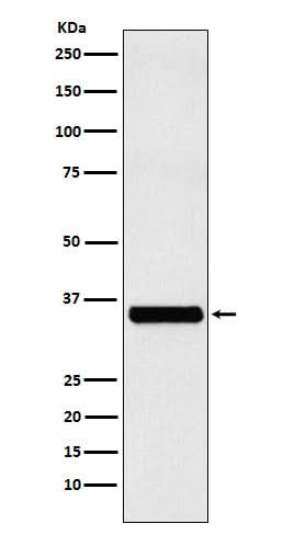 Anti-EXOSC7 Rabbit Monoclonal Antibody Boster Bio