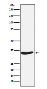 Anti-EXOSC7 Rabbit Monoclonal Antibody Boster Bio