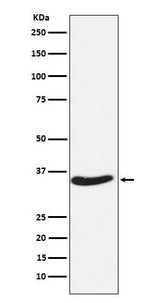Anti-EXOSC7 Rabbit Monoclonal Antibody Boster Bio