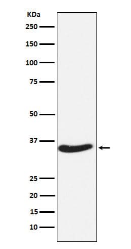Anti-EXOSC7 Rabbit Monoclonal Antibody Boster Bio