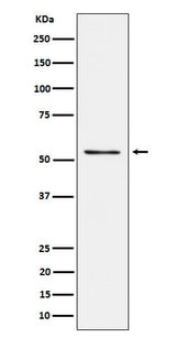 Anti-Prostein Rabbit Monoclonal Antibody Boster Bio