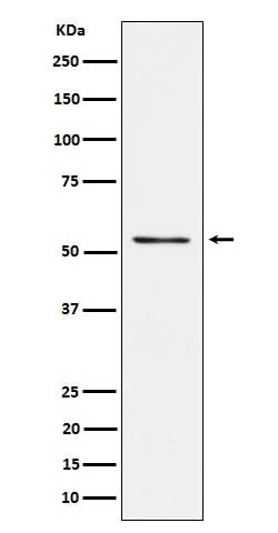 Anti-Prostein Rabbit Monoclonal Antibody Boster Bio