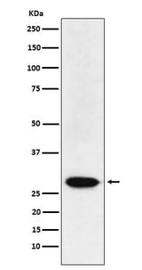 Anti-MAD3 Rabbit Monoclonal Antibody Boster Bio
