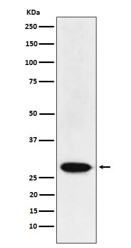 Anti-MAD3 Rabbit Monoclonal Antibody Boster Bio