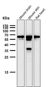 Anti-TFIIE alpha Rabbit Monoclonal Antibody Boster Bio