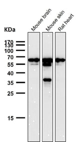 Anti-TFIIE alpha Rabbit Monoclonal Antibody Boster Bio