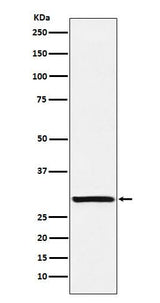 Anti-Intra Acrosomal Protein Rabbit Monoclonal Antibody Boster Bio