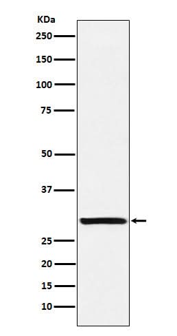 Anti-Intra Acrosomal Protein Rabbit Monoclonal Antibody Boster Bio