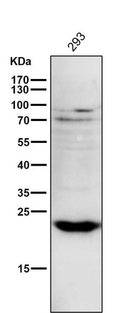 Anti-PPP1R1A Rabbit Monoclonal Antibody Boster Bio
