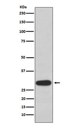 Anti-Olig3 Rabbit Monoclonal Antibody Boster Bio