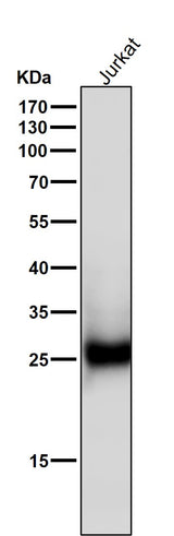 Anti-ZNRF2 Rabbit Monoclonal Antibody Boster Bio
