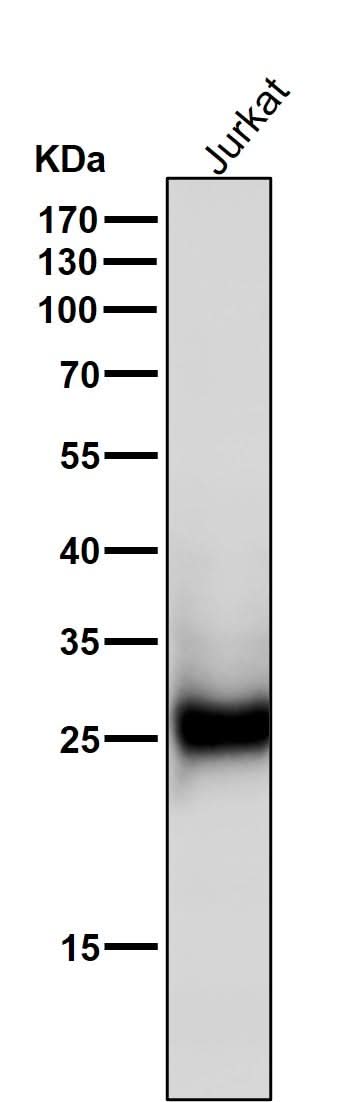 Anti-ZNRF2 Rabbit Monoclonal Antibody Boster Bio