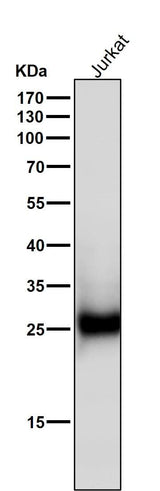Anti-ZNRF2 Rabbit Monoclonal Antibody Boster Bio