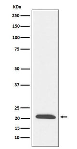 Anti-DCTN3 Rabbit Monoclonal Antibody Boster Bio