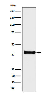 Anti-ALS2CR1 Rabbit Monoclonal Antibody Boster Bio