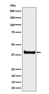 Anti-ALS2CR1 Rabbit Monoclonal Antibody Boster Bio