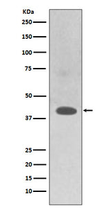 Anti-TRAM2 Rabbit Monoclonal Antibody Boster Bio