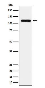 Anti-UBE4A Rabbit Monoclonal Antibody Boster Bio