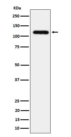 Anti-UBE4A Rabbit Monoclonal Antibody Boster Bio