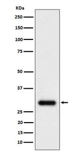 Anti-TMEM192 Rabbit Monoclonal Antibody Boster Bio