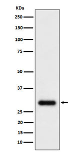 Anti-TMEM192 Rabbit Monoclonal Antibody Boster Bio
