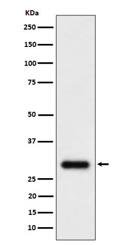 Anti-TMEM192 Rabbit Monoclonal Antibody Boster Bio