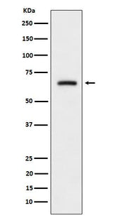 Anti-CRMP3 Rabbit Monoclonal Antibody Boster Bio