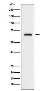Anti-CRMP3 Rabbit Monoclonal Antibody Boster Bio