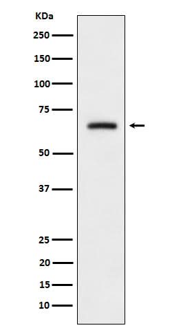 Anti-CRMP3 Rabbit Monoclonal Antibody Boster Bio