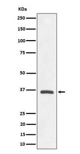 Anti-OXGR1 / GPR99 Rabbit Monoclonal Antibody Boster Bio
