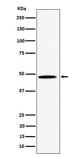 Anti-HIF Prolyl Hydroxylases Rabbit Monoclonal Antibody Boster Bio