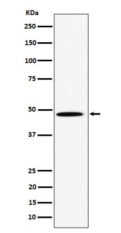 Anti-HIF Prolyl Hydroxylases Rabbit Monoclonal Antibody Boster Bio