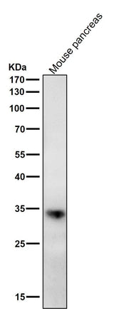 Anti-ERP27 Rabbit Monoclonal Antibody Boster Bio