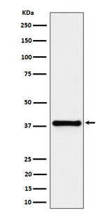 Anti-UCHL5IP Rabbit Monoclonal Antibody Boster Bio
