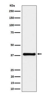 Anti-UCHL5IP Rabbit Monoclonal Antibody Boster Bio