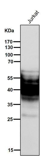 Anti-SYPL1 Rabbit Monoclonal Antibody Boster Bio