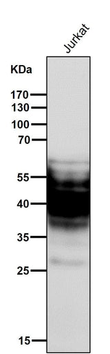 Anti-SYPL1 Rabbit Monoclonal Antibody Boster Bio