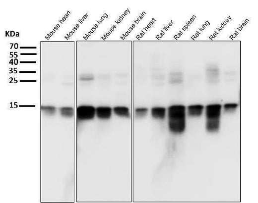 Anti-Histone H3 HIST1H3A Rabbit Monoclonal Antibody Boster Bio