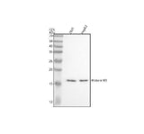 Anti-Histone H3 (acetyl K9) Rabbit Monoclonal Antibody Boster Bio