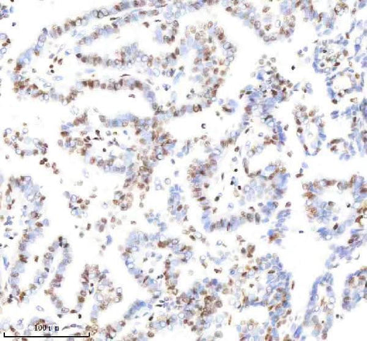 Anti-Histone H3 (acetyl K9) Rabbit Monoclonal Antibody Boster Bio