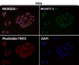 Anti-Histone H3 (mono methyl R2) HIST1H3A Rabbit Monoclonal Antibody Boster Bio
