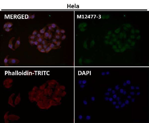 Anti-Histone H3 (mono methyl R2) HIST1H3A Rabbit Monoclonal Antibody Boster Bio