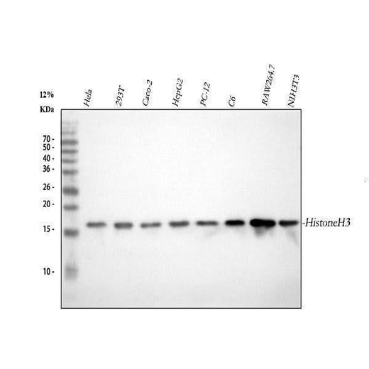 Anti-Histone H3 (mono methyl K18) HIST1H3A Rabbit Monoclonal Antibody Boster Bio