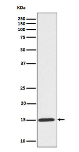 Anti-Phospho-Histone H3 (S10) Rabbit Monoclonal Antibody Boster Bio