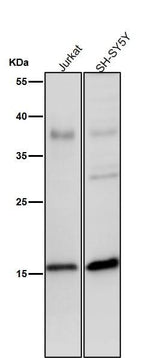 Anti-Phospho-Histone H3 (S28) Rabbit Monoclonal Antibody Boster Bio