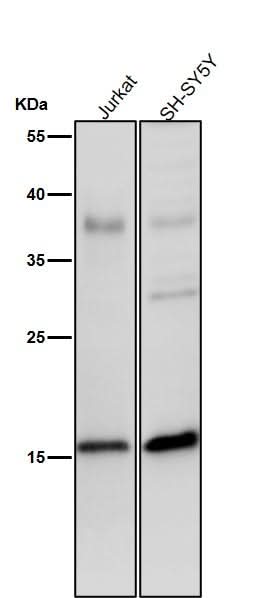 Anti-Phospho-Histone H3 (S28) Rabbit Monoclonal Antibody Boster Bio