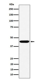 Anti-KCTD9 Rabbit Monoclonal Antibody Boster Bio