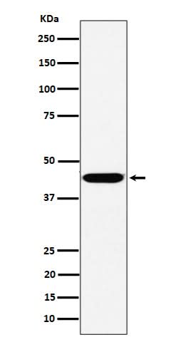 Anti-KCTD9 Rabbit Monoclonal Antibody Boster Bio