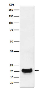 Anti-DCTN5 Rabbit Monoclonal Antibody Boster Bio